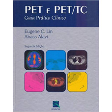 PET e PET/TC: Guia Prático Clínico 