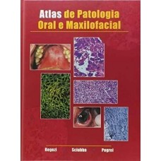 Atlas de patologia oral e maxilofacial